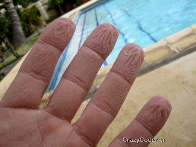 发泡剂,医学新知 手指发泡源于排水